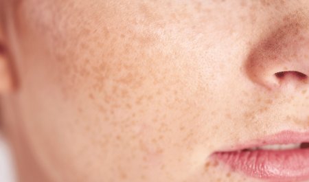 Focus on sensitive skin Focus on sensitive skin
